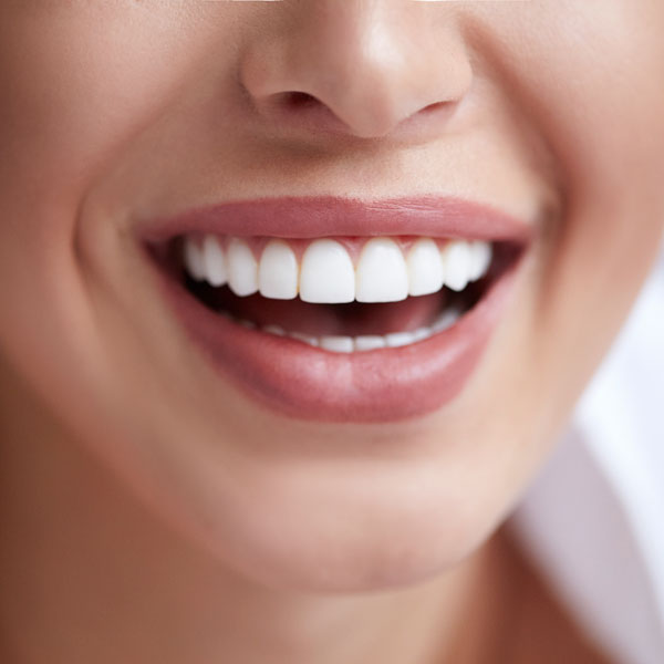 closeup of woman's straight white teeth