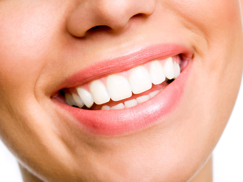 closeup of woman's teeth